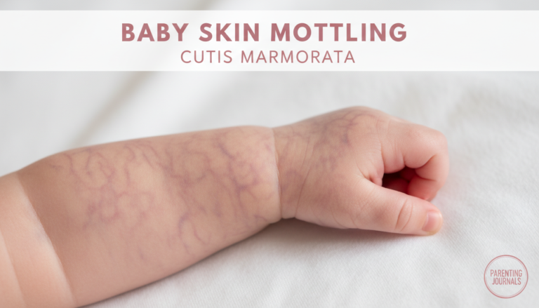 Baby skin mottling cutis marmorata