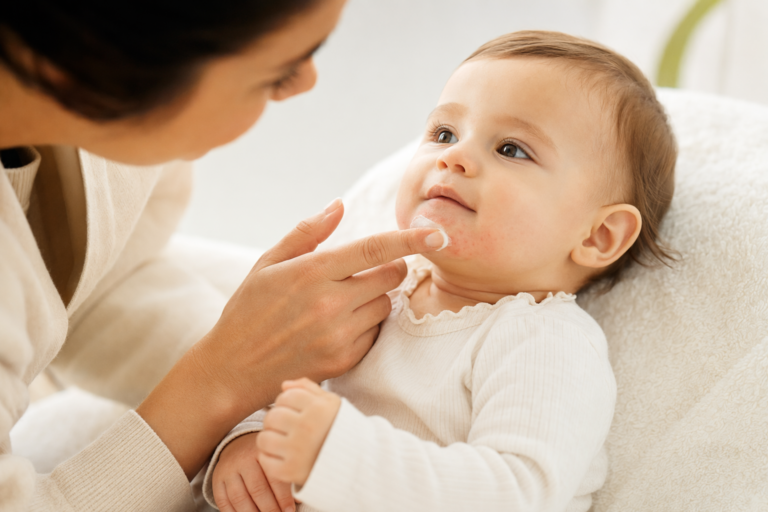 Baby teething rash around mouth treatment
